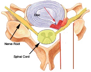 Free Illustration Cervical spine - posterior