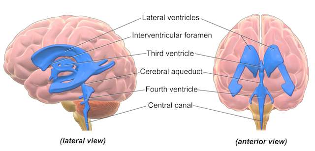 hydrocephalus ventriculostomy